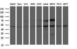 Western Blot: ANKMY2 Antibody (1F11) [NBP2-46524] - Analysis of extracts (35ug) from 9 different cell lines by using ANKMY2 monoclonal antibody (HepG2: human; HeLa: human; SVT2: mouse; A549: human; COS7: monkey; Jurkat: human; MDCK: canine; PC12: rat; MCF7: human).