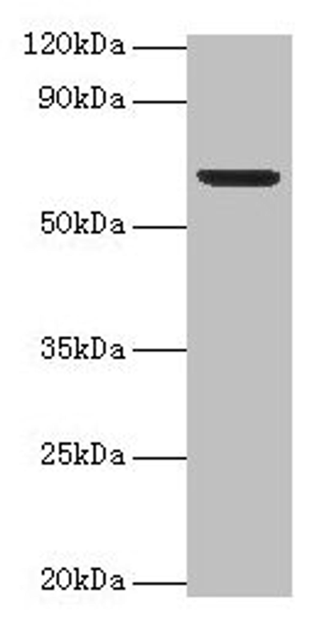 Western blot. All lanes: Plbd2 antibody at 2µg/ml + Mouse brain tissue. Secondary. Goat polyclonal to rabbit IgG at 1/15000 dilution. Predicted band size: 67, 50 kDa. Observed band size: 67 kDa