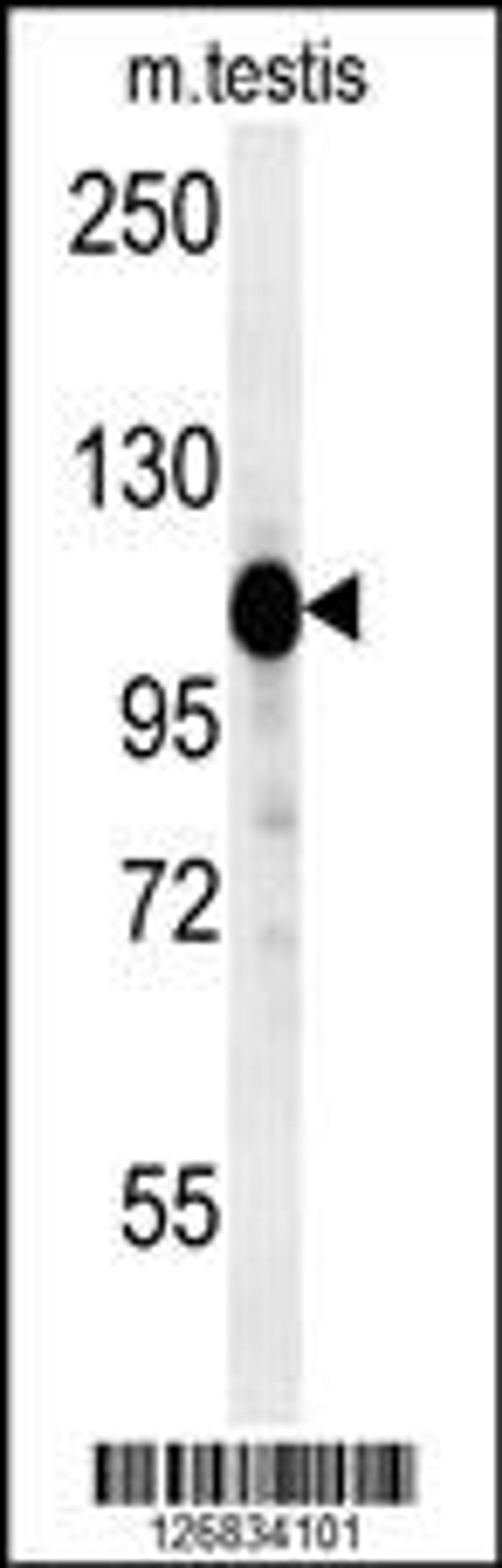 Western blot analysis in mouse testis tissue lysates (15ug/lane).This demonstrates the detected DACT1 protein (arrow).