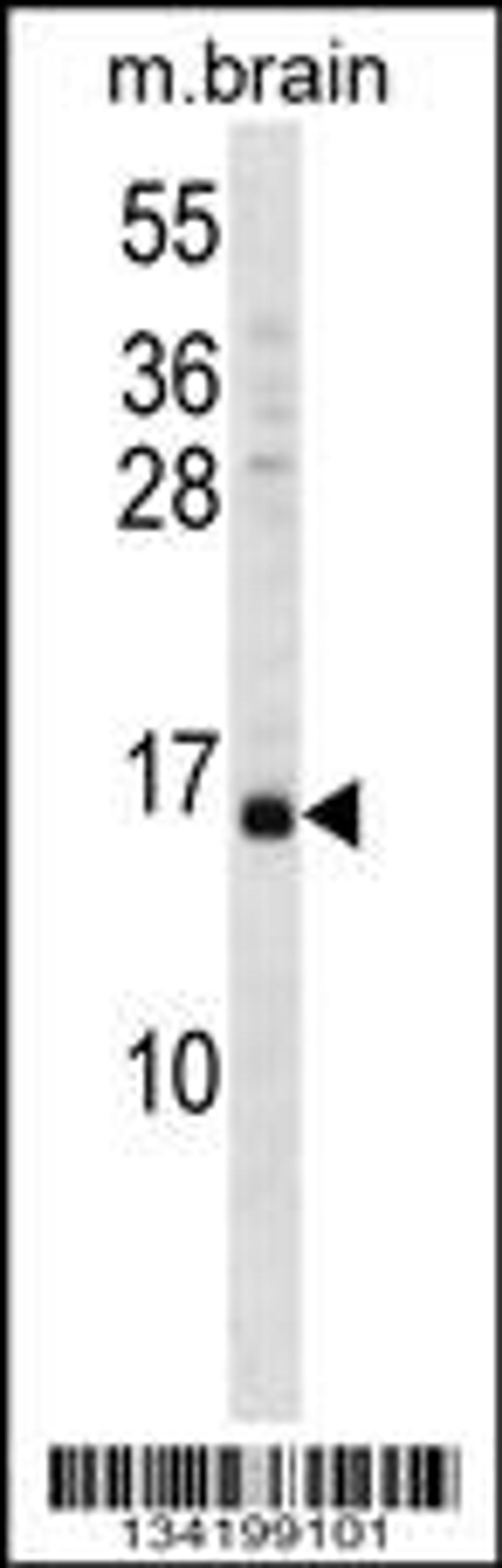 Western blot analysis in mouse brain tissue lysates (35ug/lane).