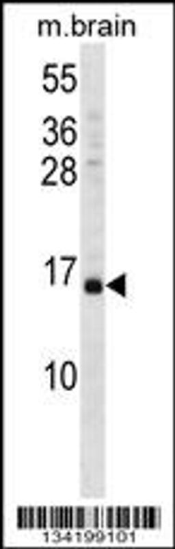 Western blot analysis in mouse brain tissue lysates (35ug/lane).