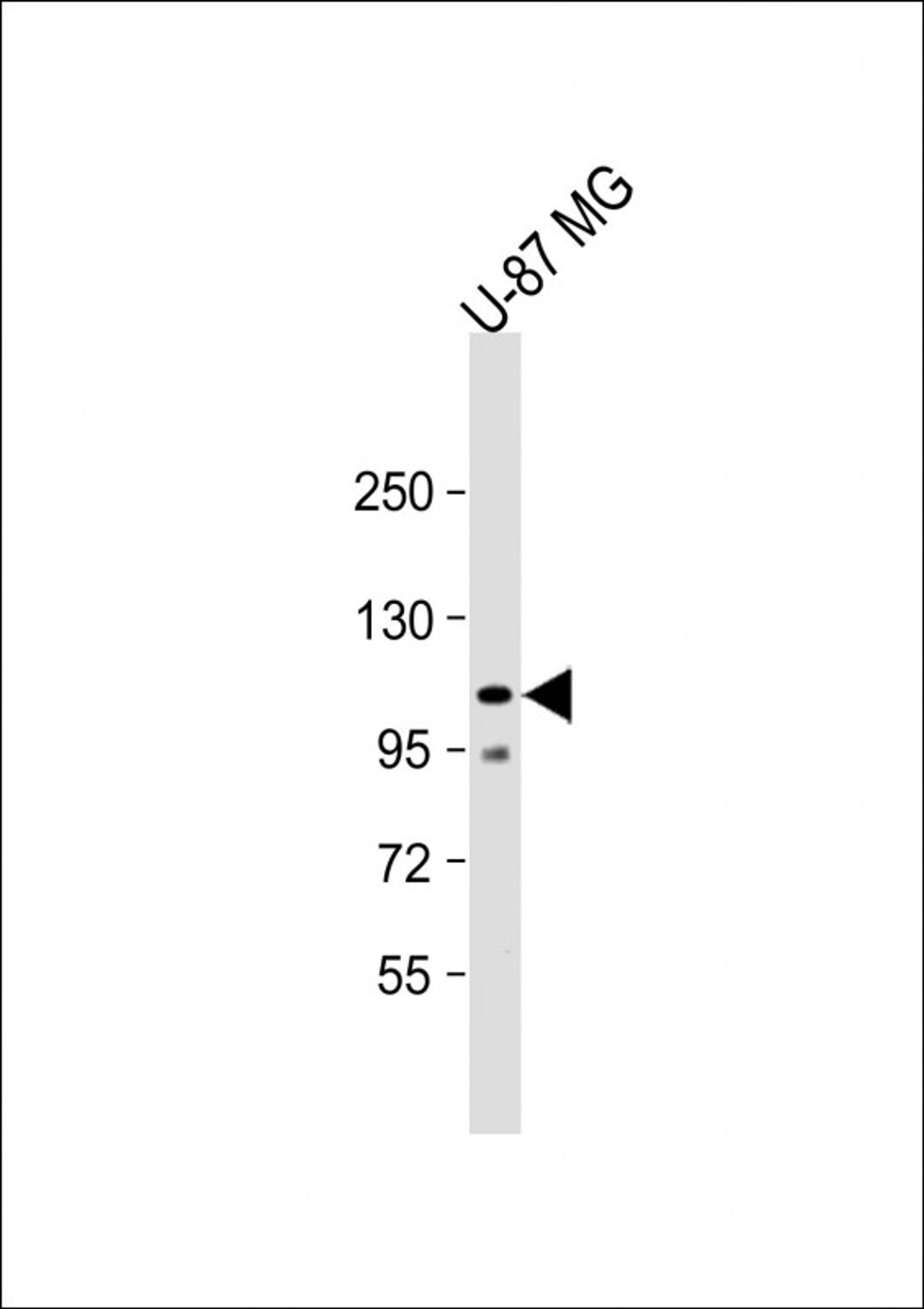 Western Blot at 1:1000 dilution + U-87 MG whole cell lysate Lysates/proteins at 20 ug per lane.