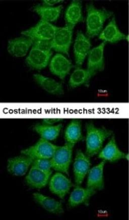 Immunocytochemistry/Immunofluorescence: UBE4B Antibody [NBP1-32737] - Analysis of methanol-fixed Hep3B, using antibody at 1:500 dilution.