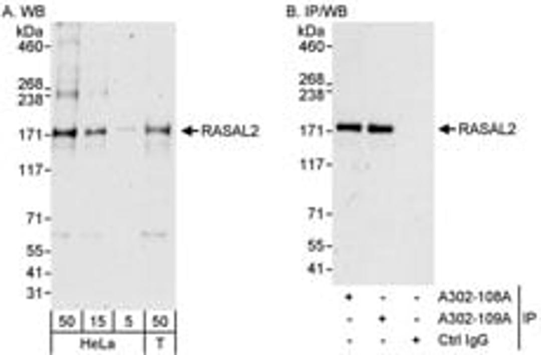 Detection of human RASAL2 by western blot and immunoprecipitation.