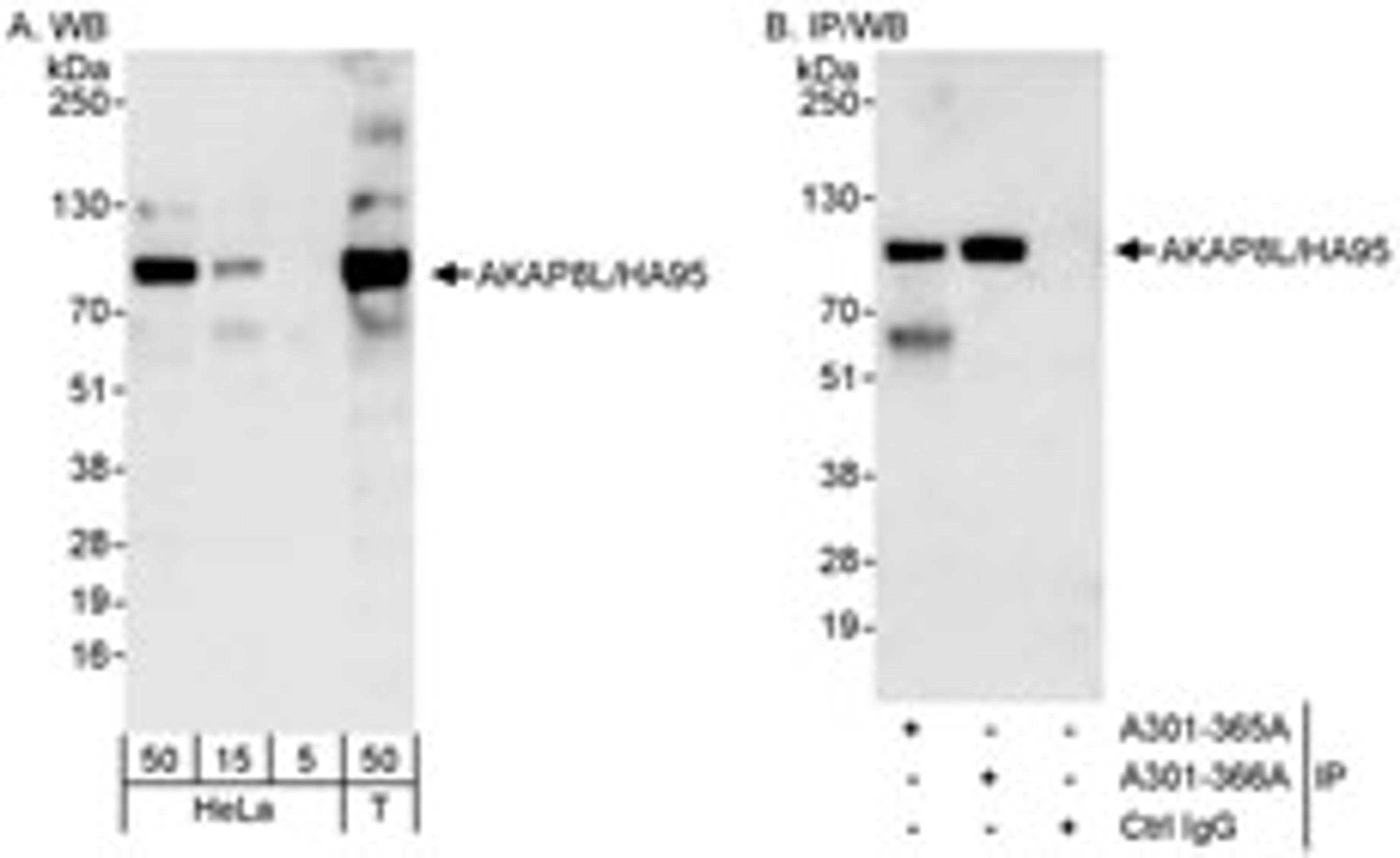 Detection of human AKAP8L/HA95 by western blot and immunoprecipitation.