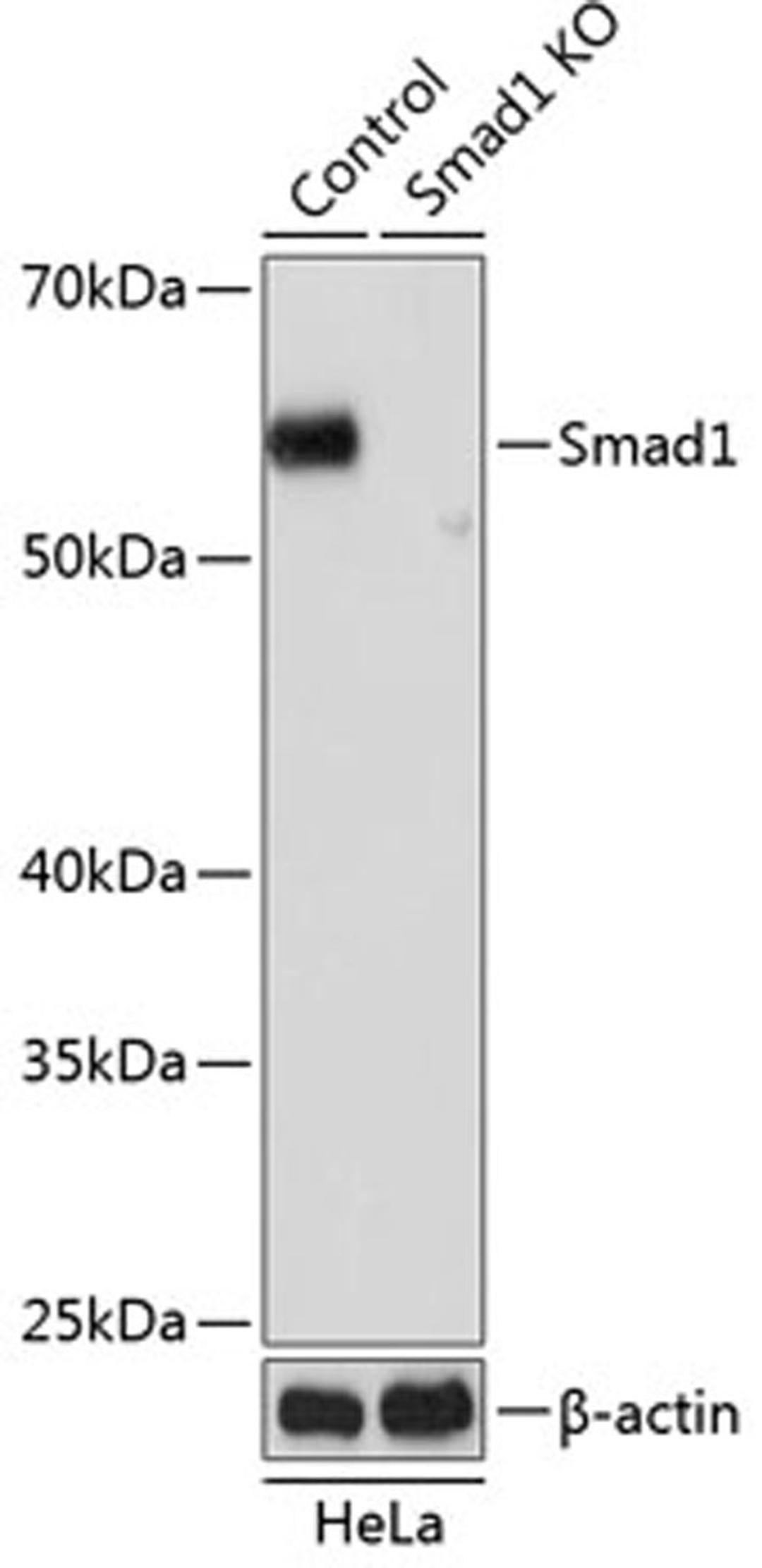 Western blot - Smad1 antibody (A19113)