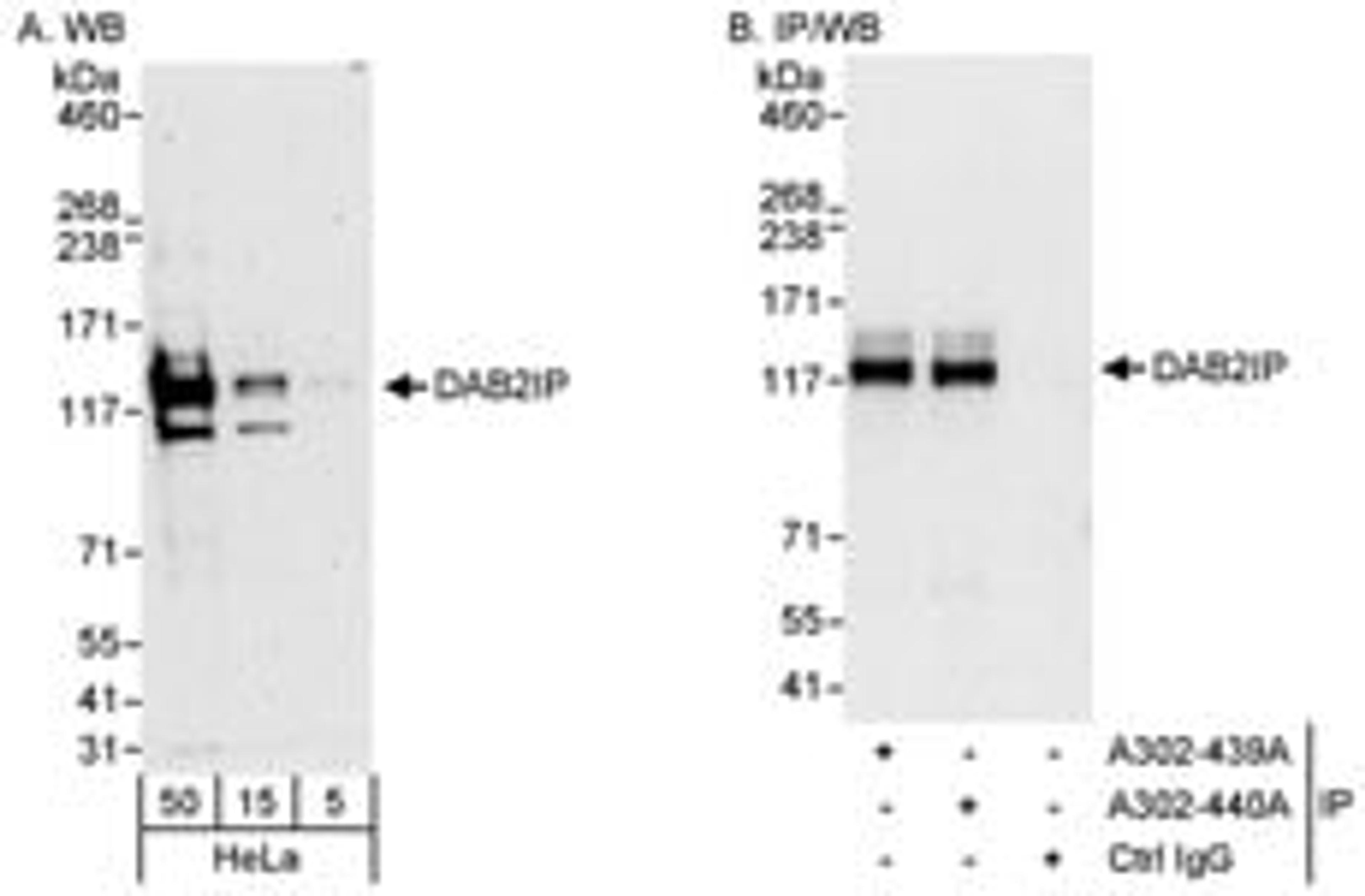 Detection of human DAB2IP by western blot and immunoprecipitation.