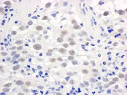 Detection of human PELP1/MNAR by immunohistochemistry.