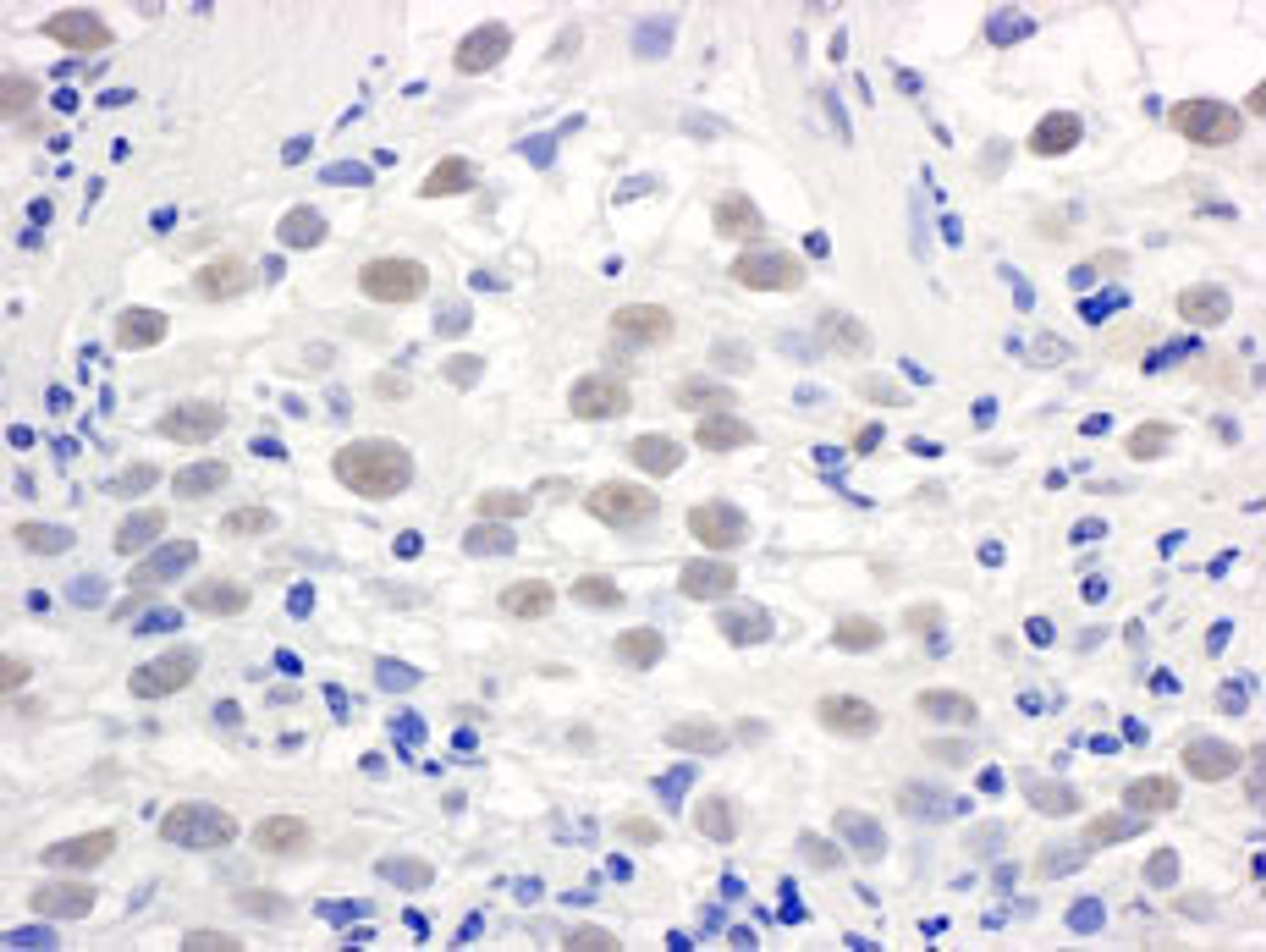 Detection of human PELP1/MNAR by immunohistochemistry.