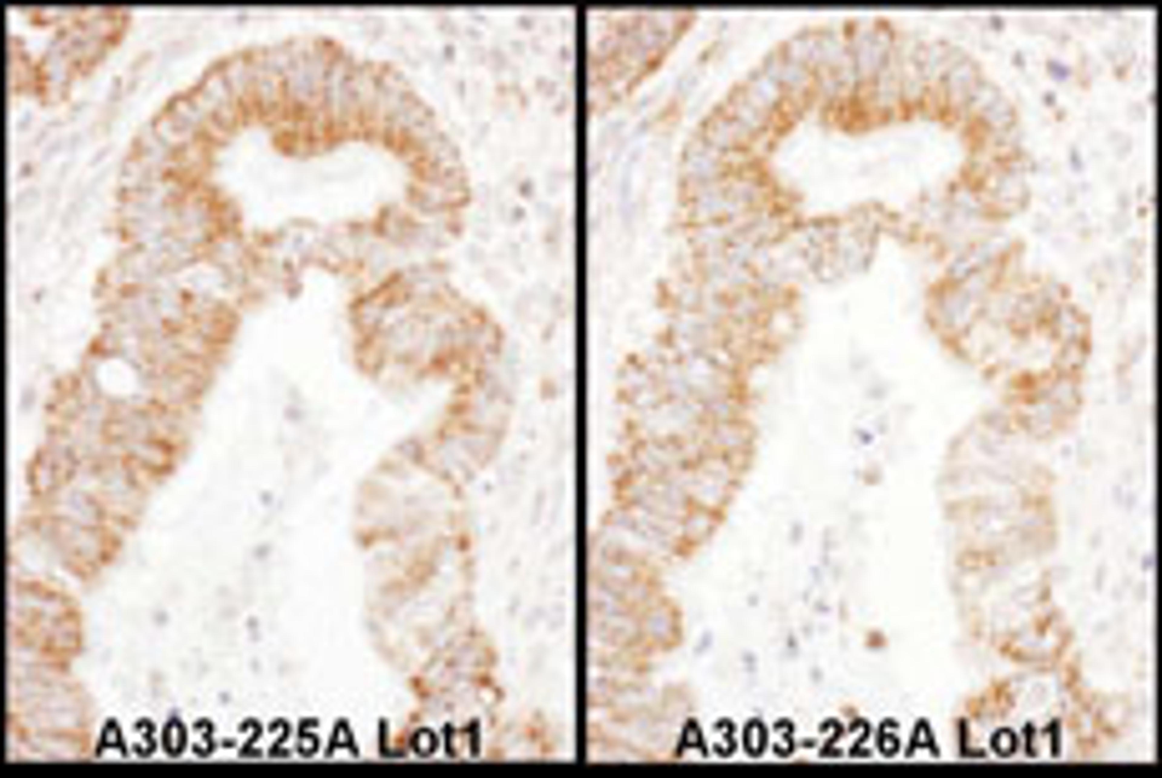 Detection of human TFAM by immunohistochemistry.