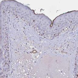 Immunohistochemistry: IGSF2/CD101 Antibody [NBP2-31687] - Staining of human skin shows moderate cytoplasmic positivity in Langerhans cells.