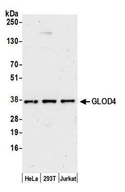 Detection of human GLOD4 by WB.