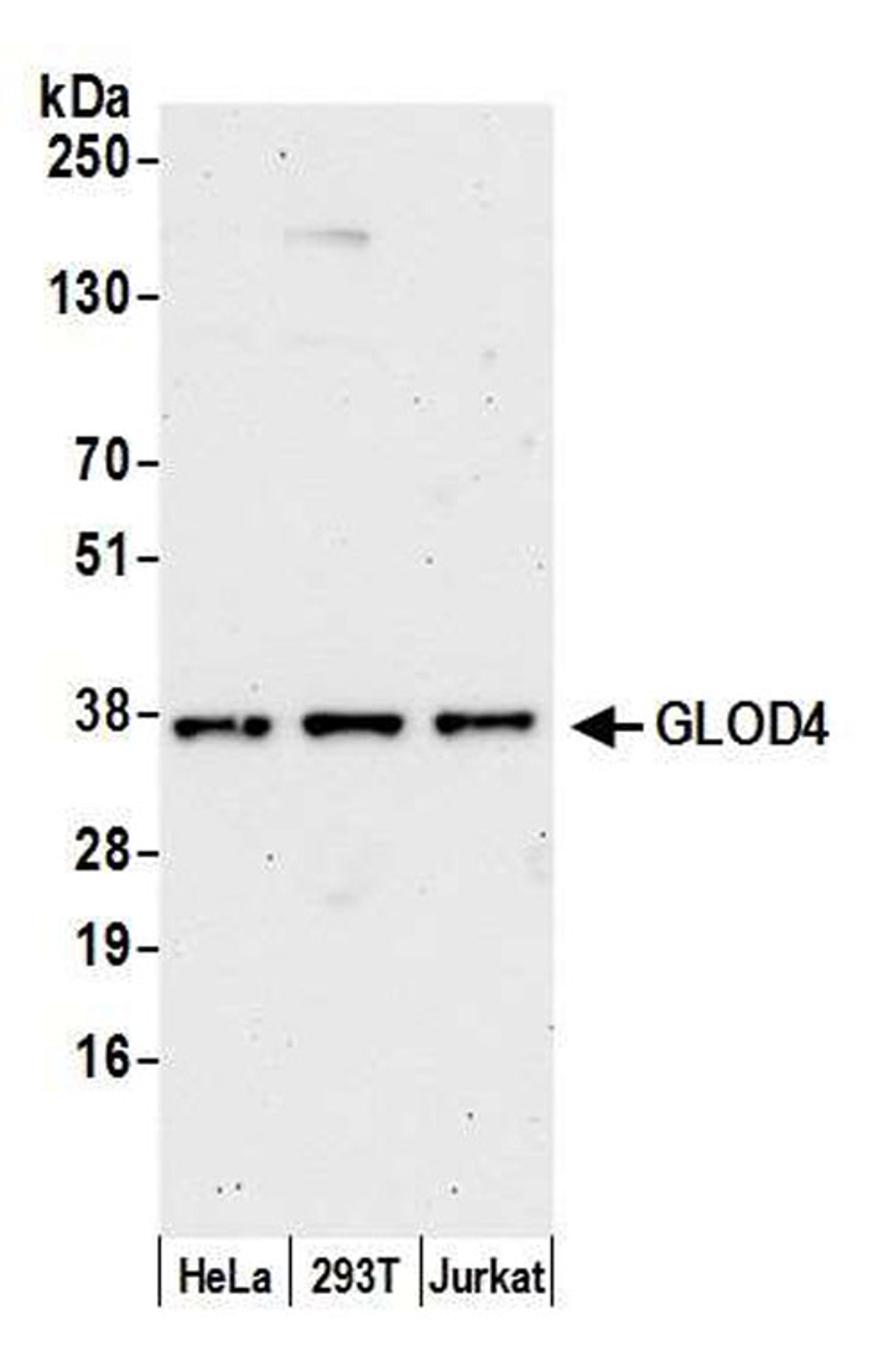 Detection of human GLOD4 by WB.