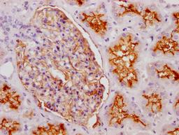 IHC image of CSB-RA187479A0HU diluted at 1:100 and staining in paraffin-embedded human kidney tissue performed on a Leica BondTM system. After dewaxing and hydration, antigen retrieval was mediated by high pressure in a citrate buffer (pH 6.0). Section was blocked with 10% normal goat serum 30min at RT. Then primary antibody (1% BSA) was incubated at 4℃ overnight. The primary is detected by a Goat anti-rabbit IgG polymer labeled by HRP and visualized using 0.05% DAB.