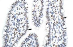 Antibody used in IHC on Human Intestine at 4.0-8.0 ug/ml.