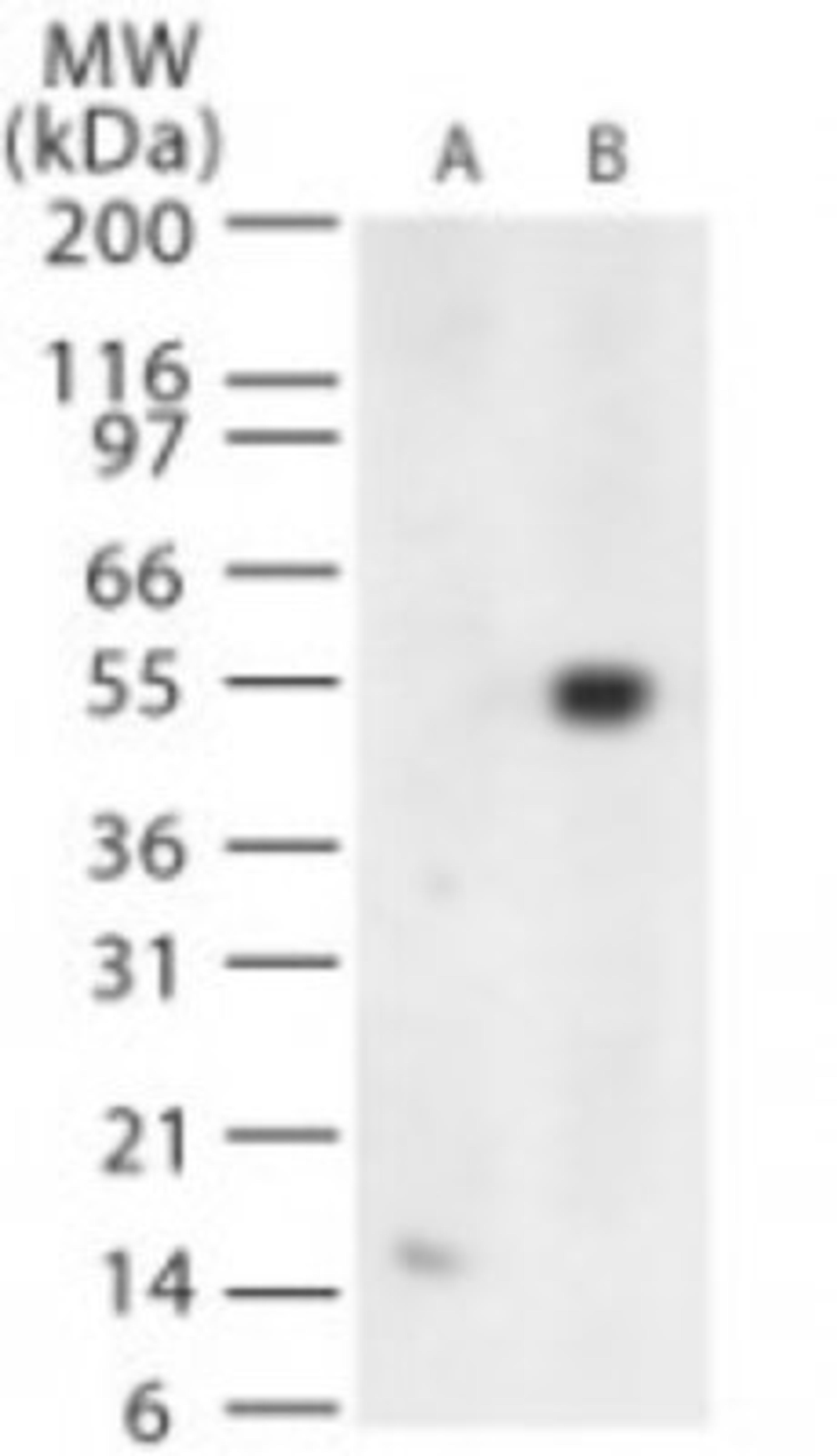 Western Blot: West Nile Virus Protein E Antibody [NB100-56744] - Analysis using the Azide Free version of NB100-56744. Detection of West Nile Virus glycoprotein E in (A) untransfected and (B) transfected cells using this antibody.