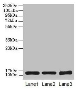 Western blot. All lanes: SNCG antibody at 16µg/ml. Lane 1: HT29 whole cell lysate. Lane 2: Mouse brain tissue. Lane 3: 293T whole cell lysate. Secondary. Goat polyclonal to rabbit IgG at 1/10000 dilution. Predicted band size: 14 kDa. Observed band size: 14 kDa