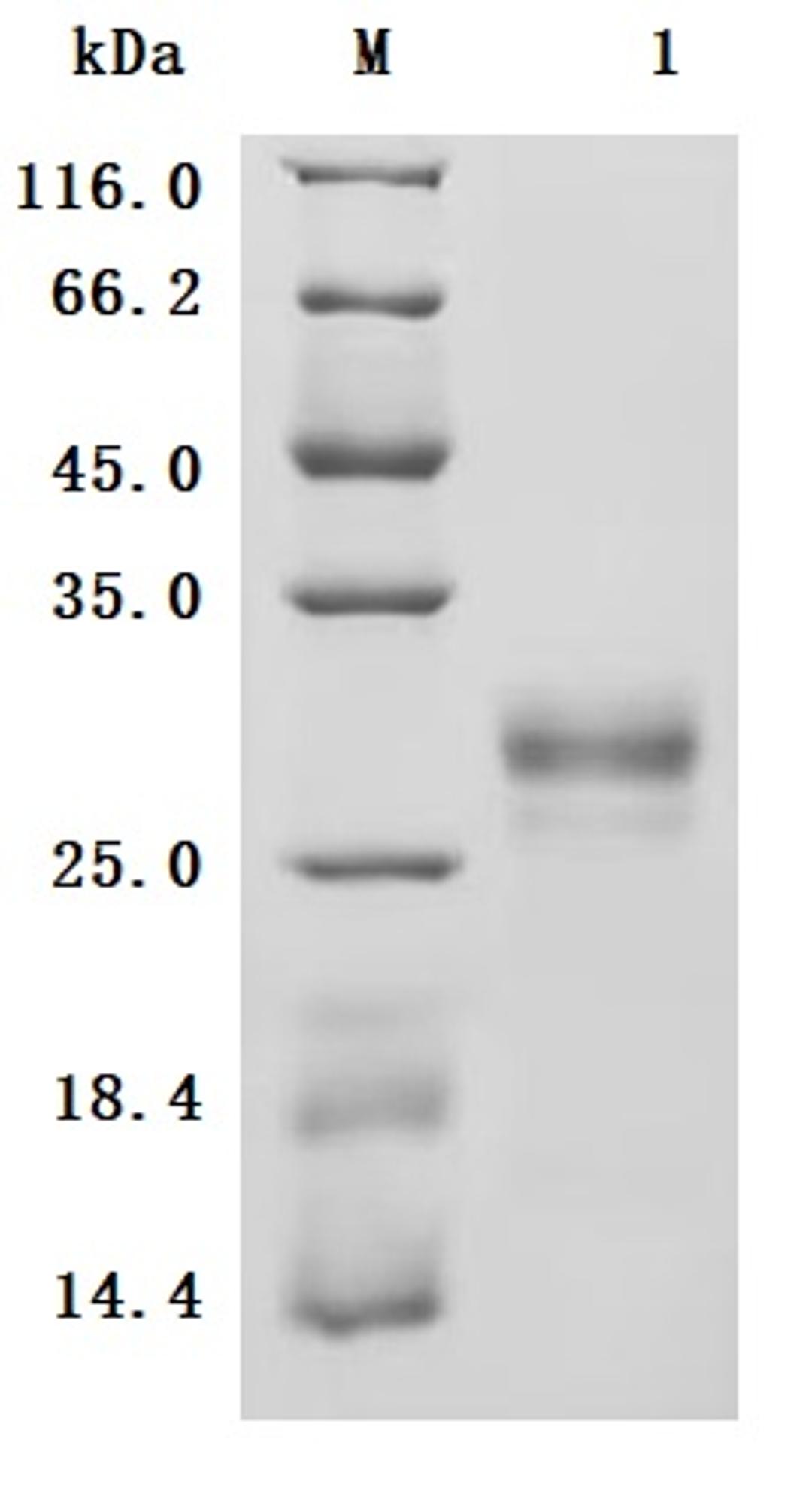 (Tris-Glycine gel) Discontinuous SDS-PAGE (reduced) with 5% enrichment gel and 15% separation gel.