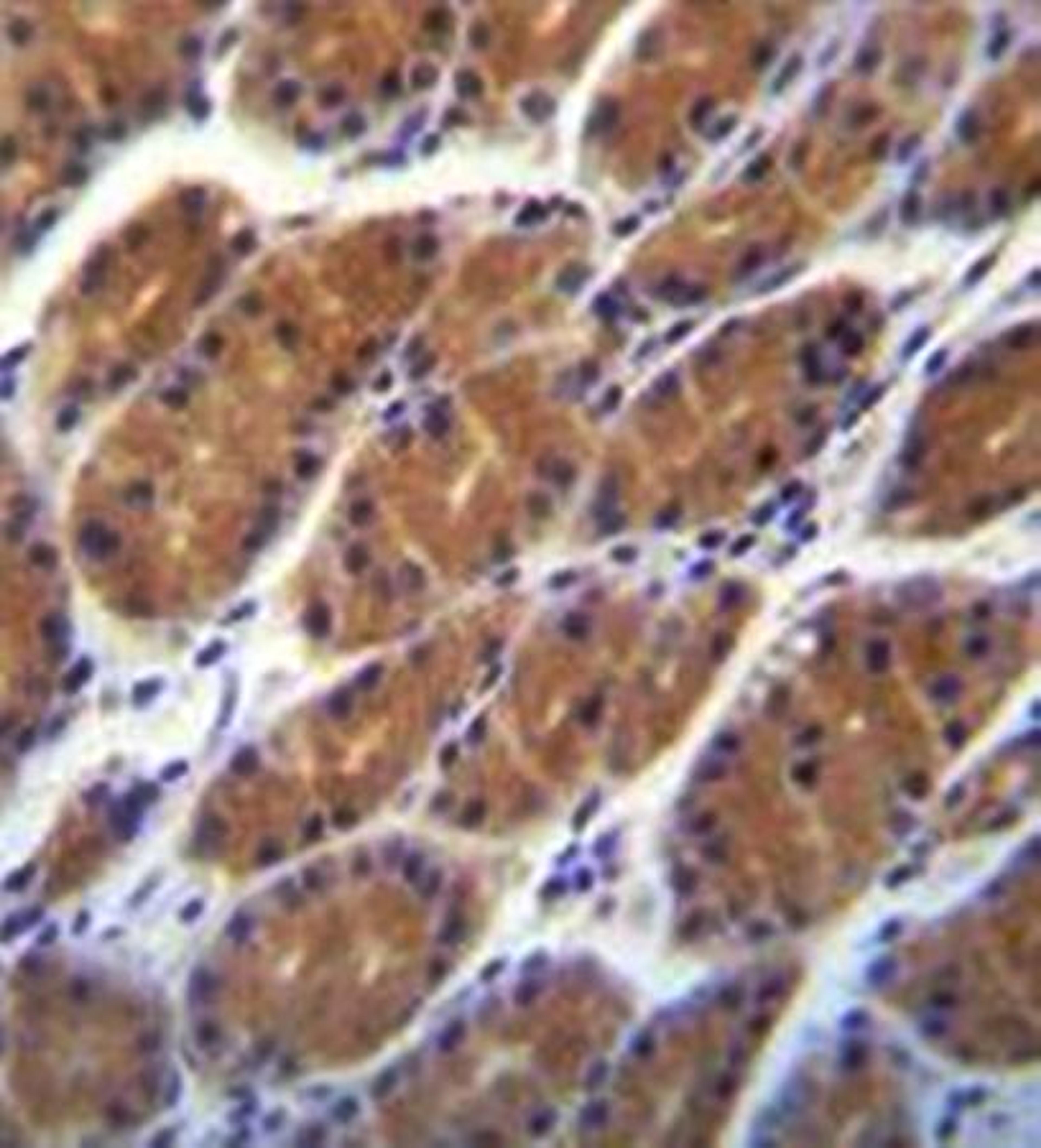 Immunohistochemical analysis of formalin fixed and paraffin embedded human stomach tissue using CLDN2 antibody 