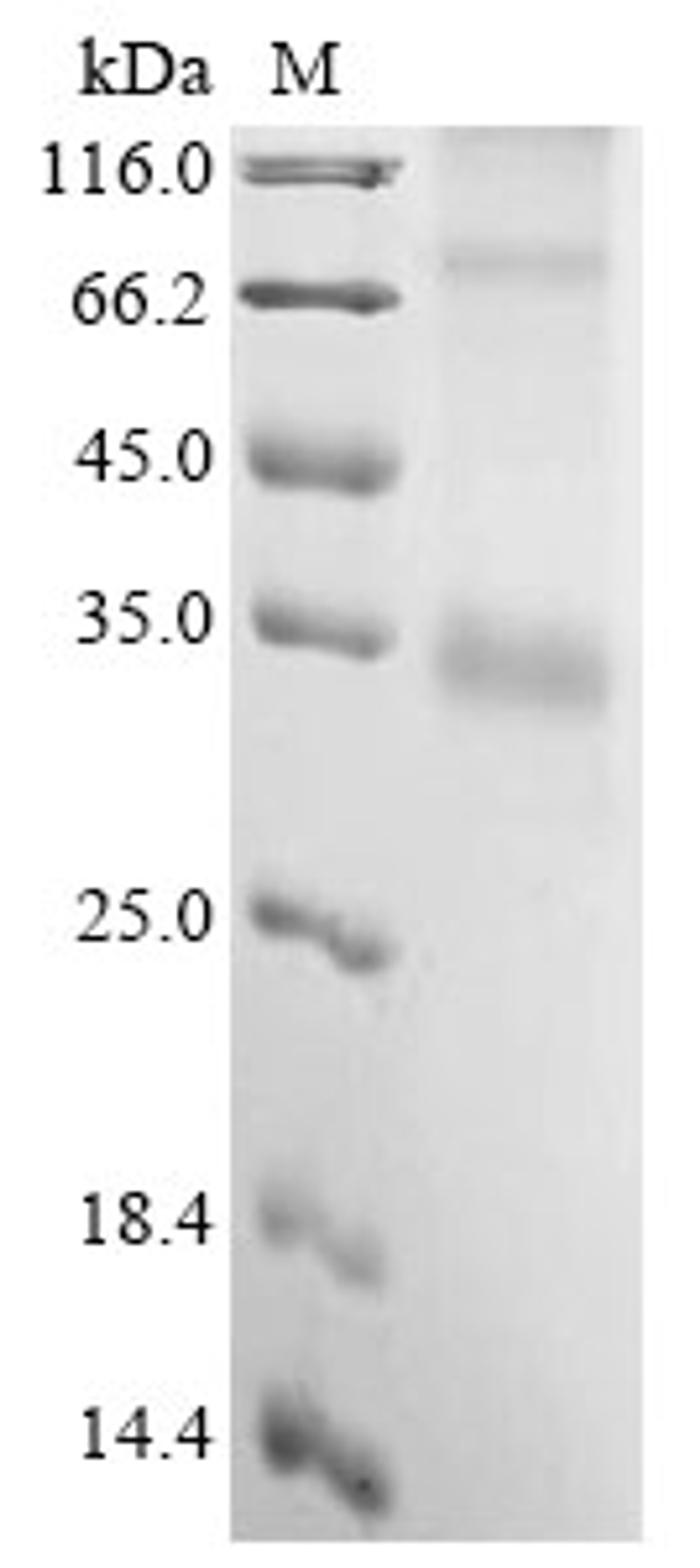 (Tris-Glycine gel) Discontinuous SDS-PAGE (reduced) with 5% enrichment gel and 15% separation gel.