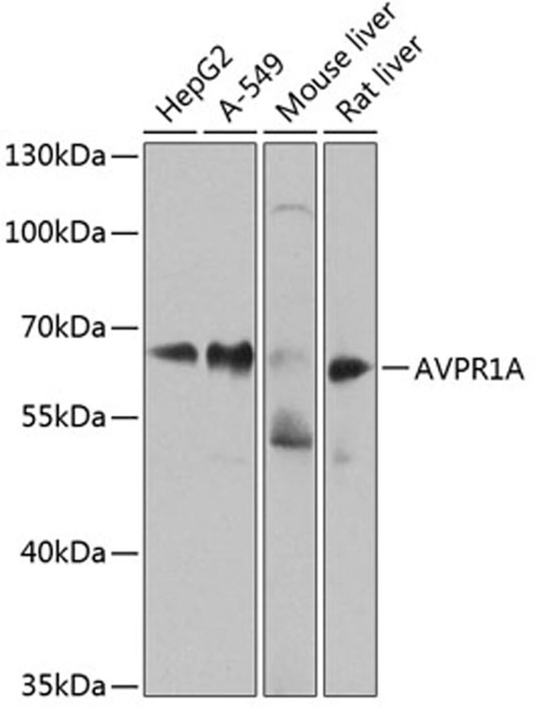 Western blot - AVPR1A antibody (A8400)