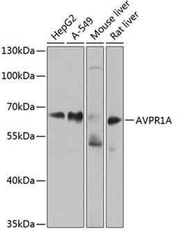 Western blot - AVPR1A antibody (A8400)