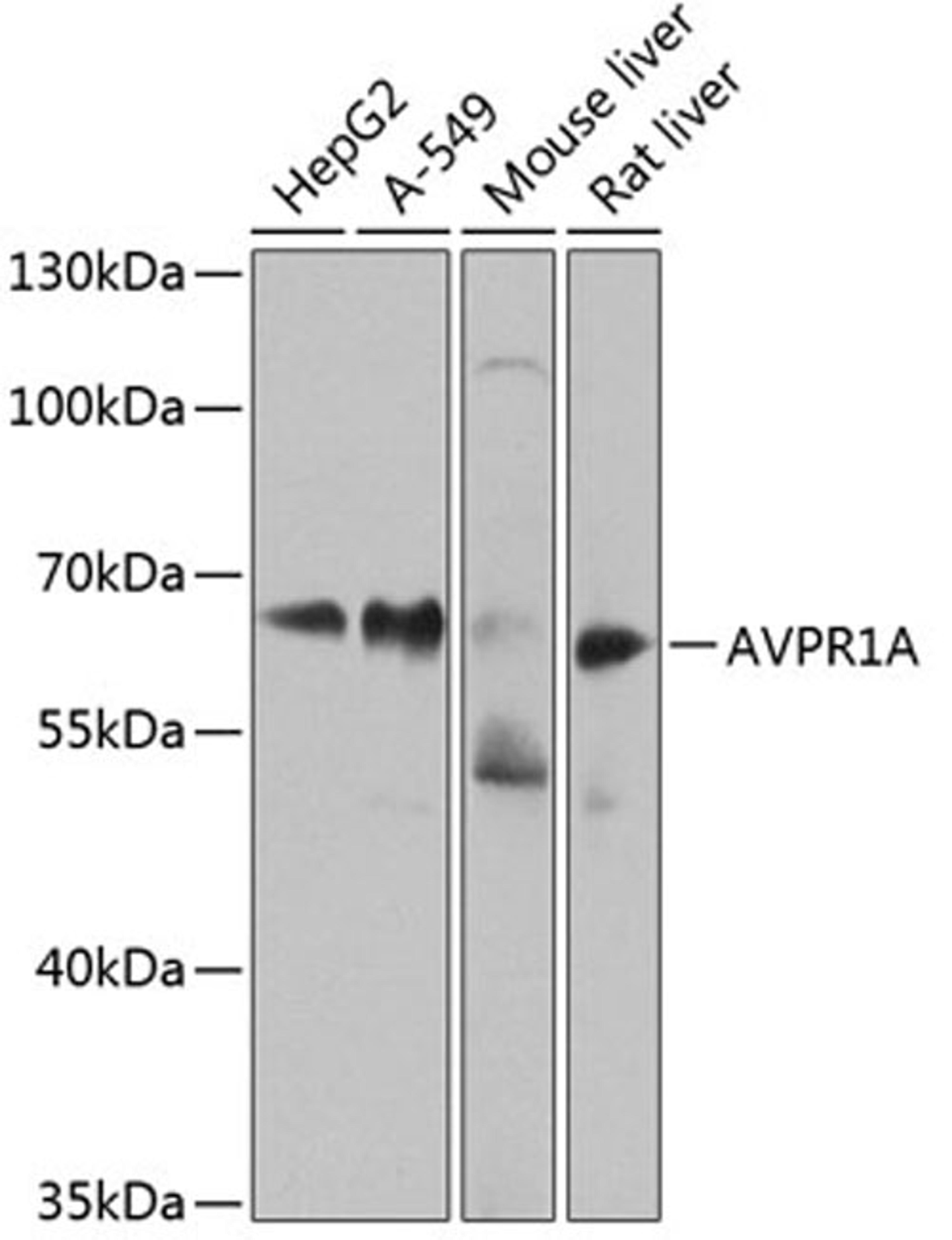 Western blot - AVPR1A antibody (A8400)