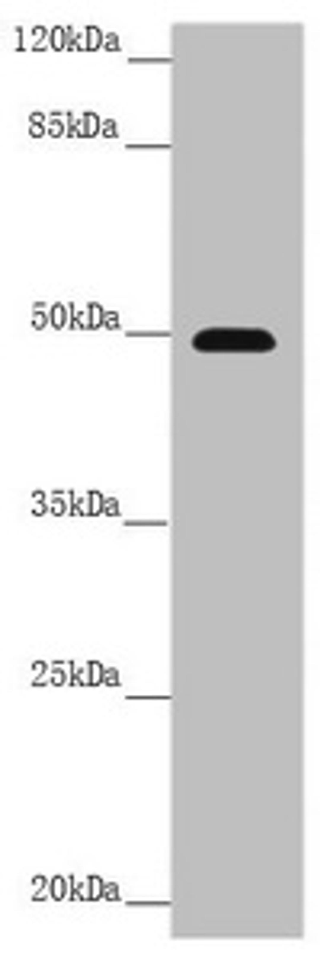 Western blot. All lanes: PSTPIP1 antibody at 3.99 ug/ml + Raw264.7 whole cell lysate. Secondary. Goat polyclonal to rabbit IgG at 1/10000 dilution. Predicted band size: 48, 46 kDa. Observed band size: 48 kDa.