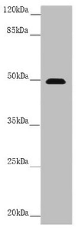 Western blot. All lanes: PSTPIP1 antibody at 3.99 ug/ml + Raw264.7 whole cell lysate. Secondary. Goat polyclonal to rabbit IgG at 1/10000 dilution. Predicted band size: 48, 46 kDa. Observed band size: 48 kDa.