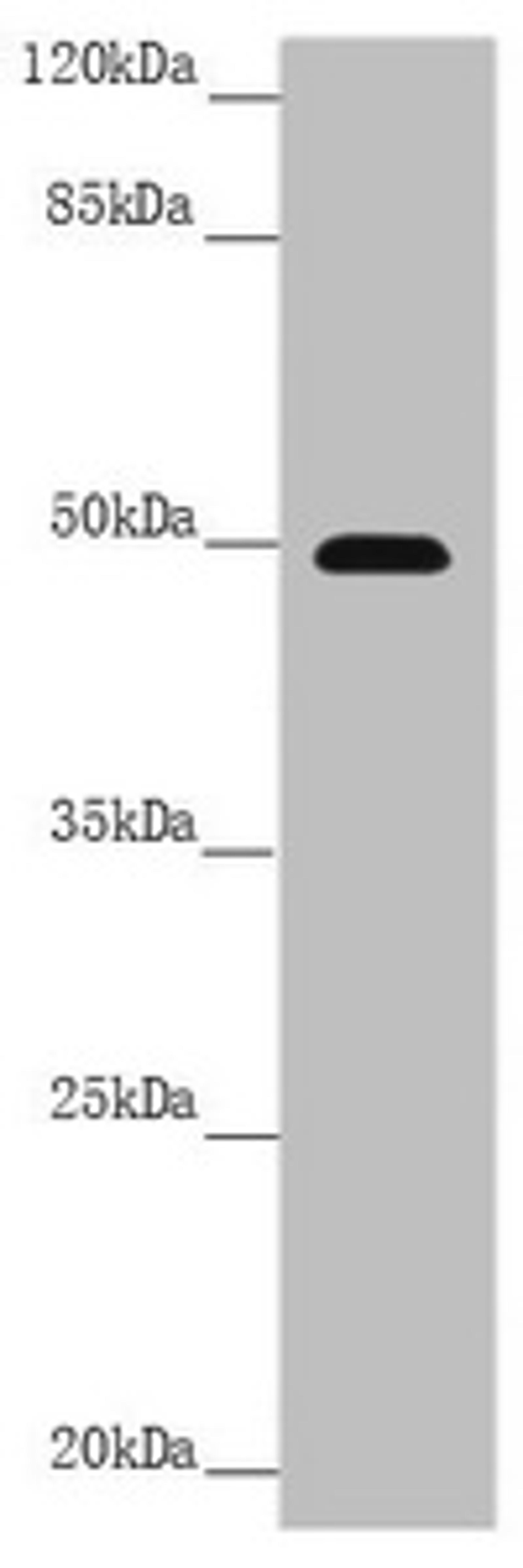 Western blot. All lanes: PSTPIP1 antibody at 3.99 ug/ml + Raw264.7 whole cell lysate. Secondary. Goat polyclonal to rabbit IgG at 1/10000 dilution. Predicted band size: 48, 46 kDa. Observed band size: 48 kDa.