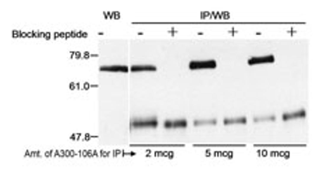 Detection of human Menin by western blot and immunoprecipitation.