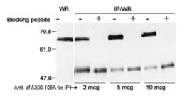 Detection of human Menin by western blot and immunoprecipitation.