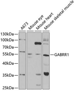 Western blot - GABRR1 antibody (A5745)