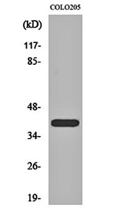 Western blot analysis of COLO205 cell lysates using PKA I beta reg antibody