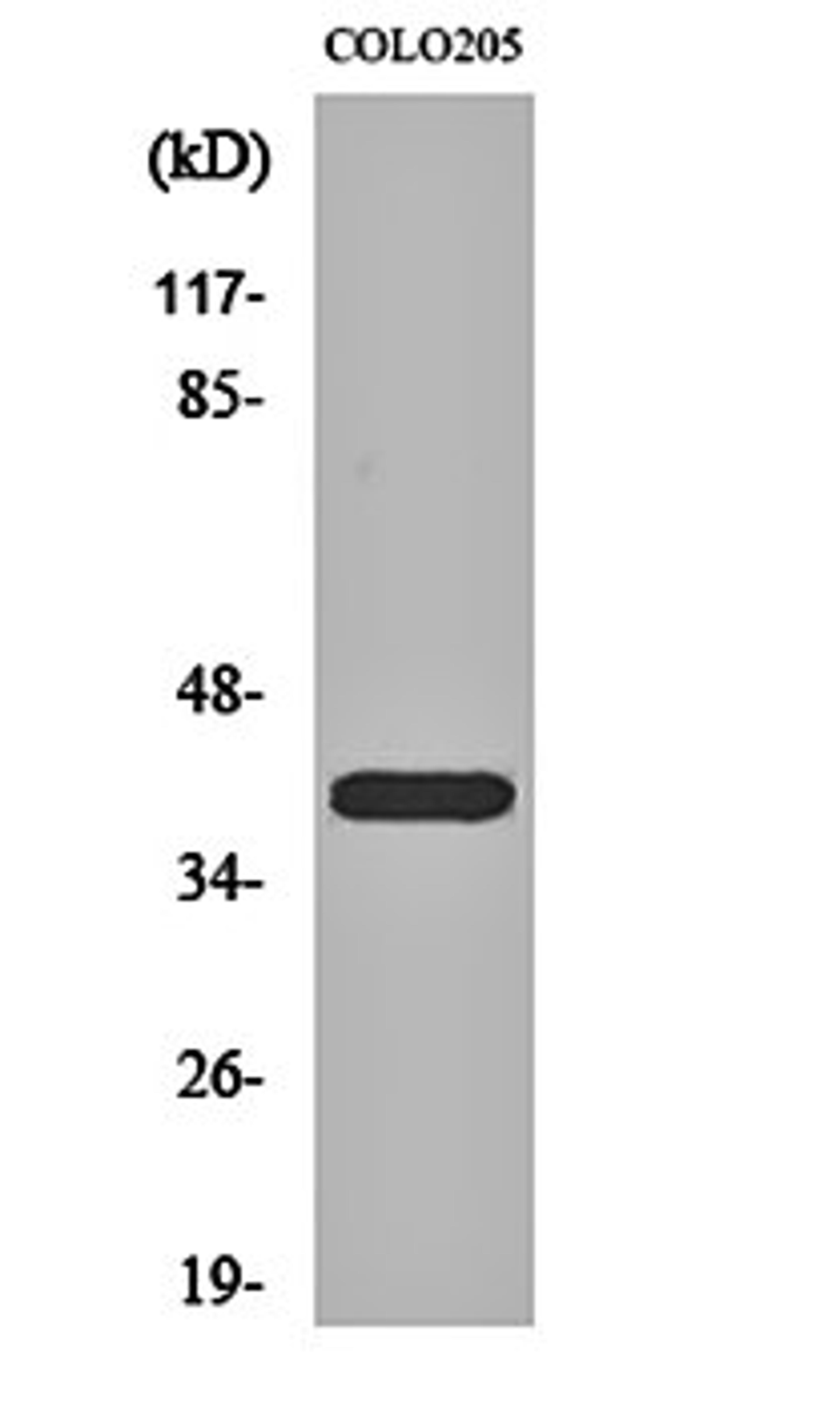 Western blot analysis of COLO205 cell lysates using PKA I beta reg antibody