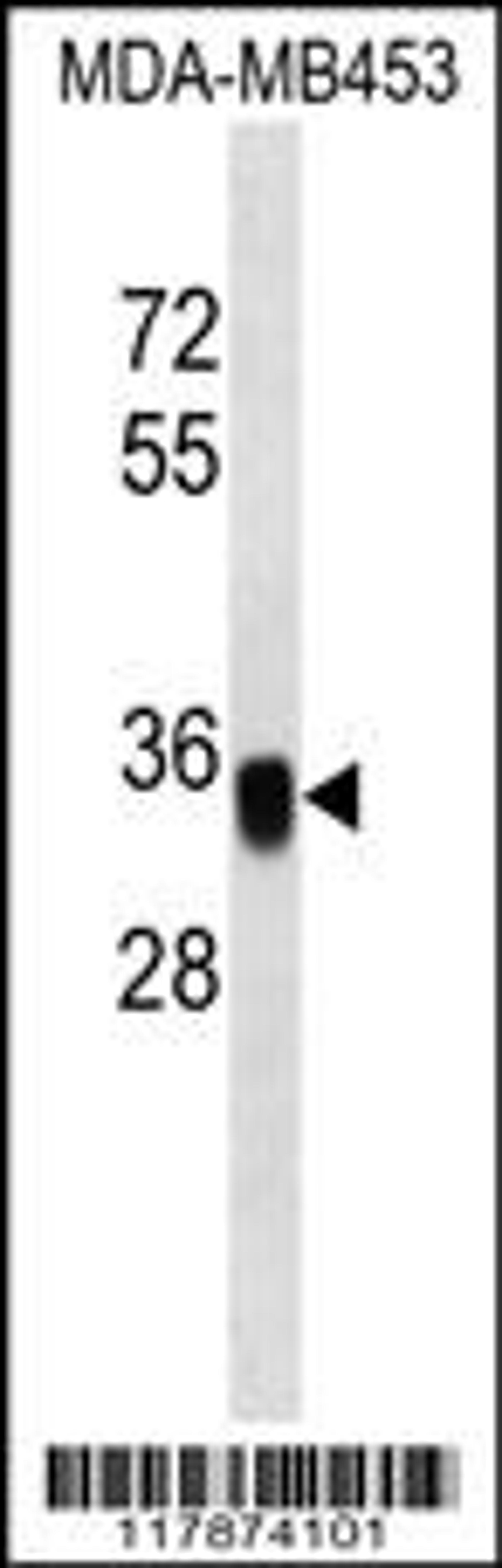 Western blot analysis in MDA-MB453 cell line lysates (35ug/lane).