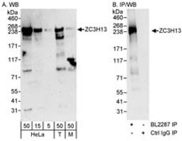 Detection of human and mouse ZC3H13 by western blot (h&m) and immunoprecipitation (h).