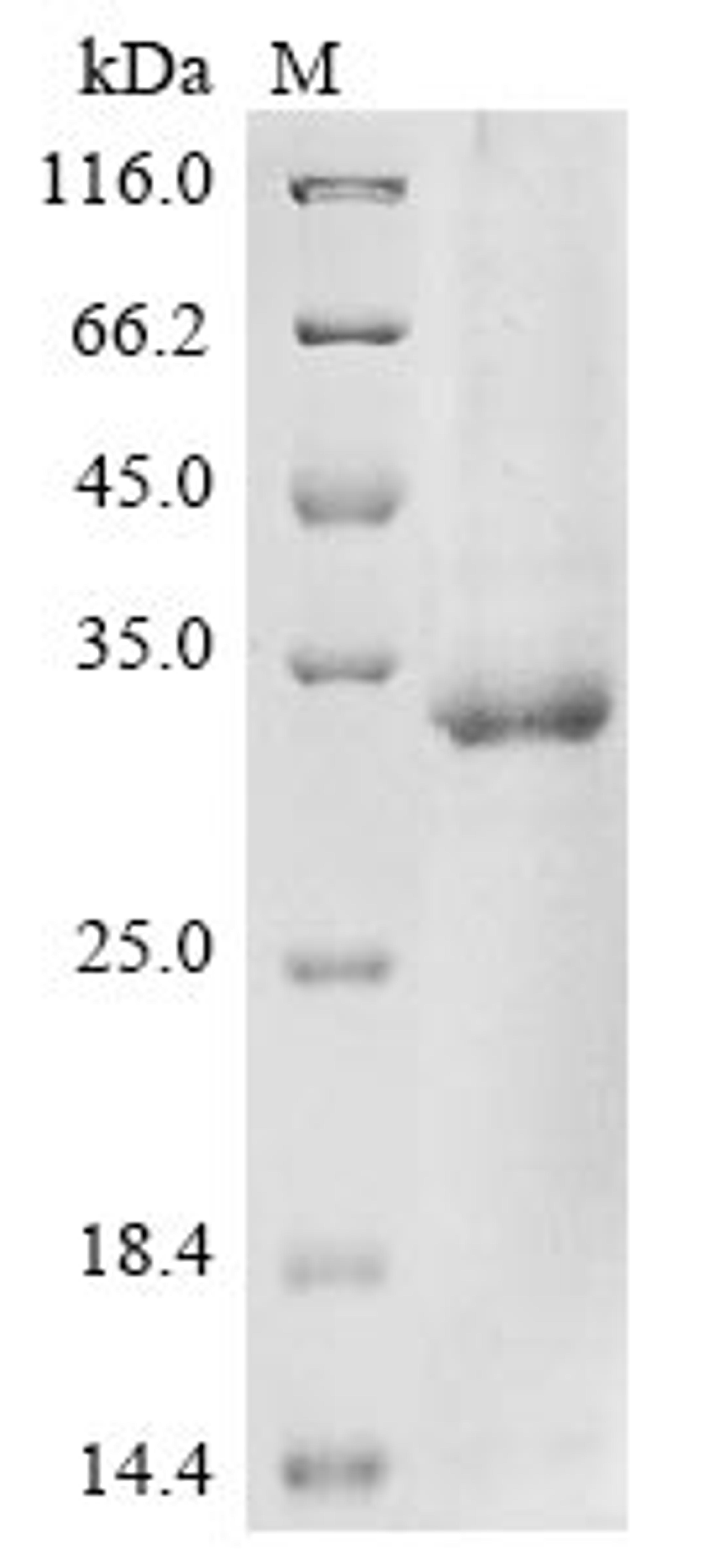 (Tris-Glycine gel) Discontinuous SDS-PAGE (reduced) with 5% enrichment gel and 15% separation gel.