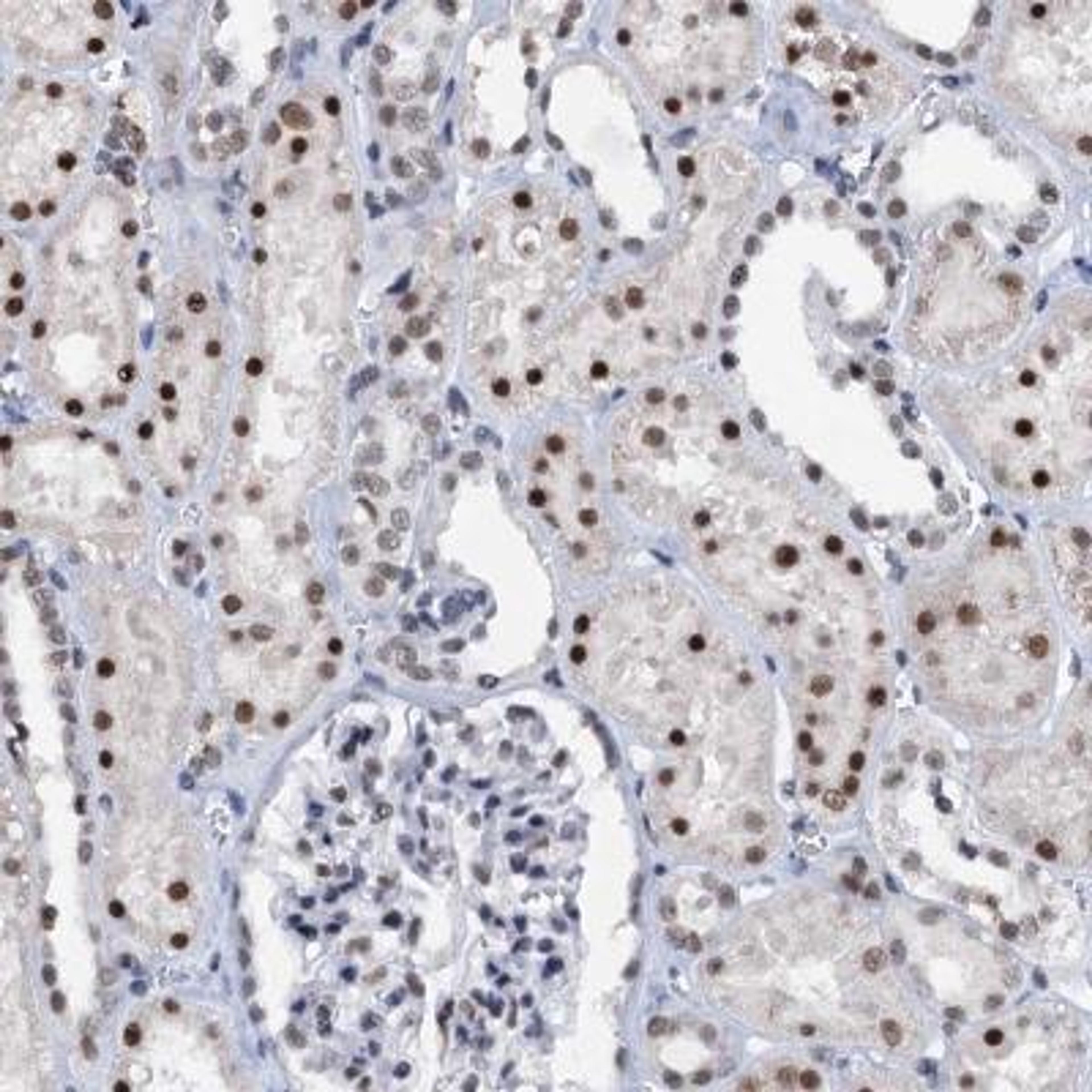 Immunohistochemistry-Paraffin: SNRPD1 Antibody - Staining of human kidney shows strong nuclear positivity in cells of tubules.