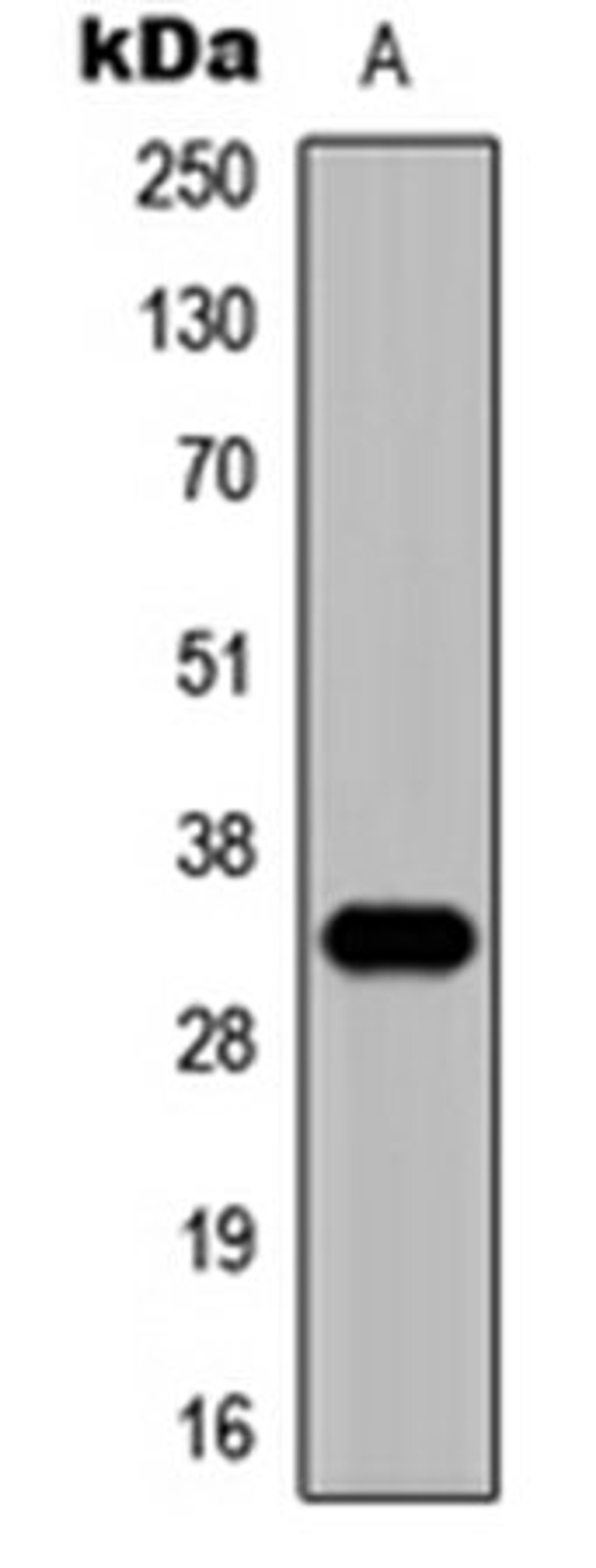 Western blot analysis of HepG2 (Lane 1) whole cell lysates using ZNF75D antibody