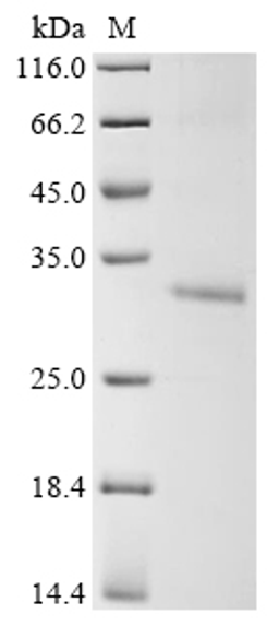 (Tris-Glycine gel) Discontinuous SDS-PAGE (reduced) with 5% enrichment gel and 15% separation gel.