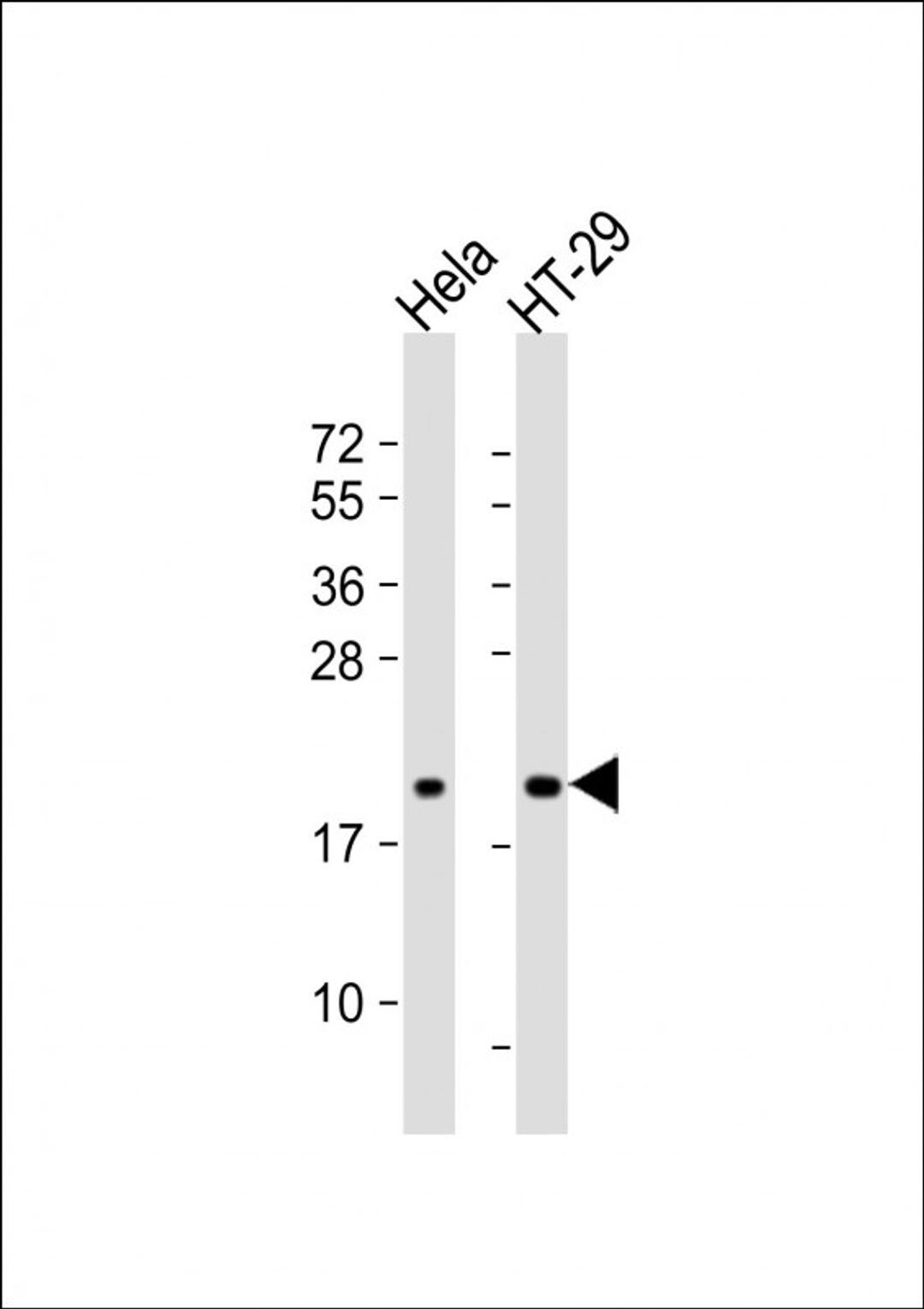 Western Blot at 1:1000 dilution Lane 1: Hela whole cell lysate Lane 2: HT-29 whole cell lysate Lysates/proteins at 20 ug per lane.