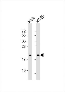 Western Blot at 1:1000 dilution Lane 1: Hela whole cell lysate Lane 2: HT-29 whole cell lysate Lysates/proteins at 20 ug per lane.