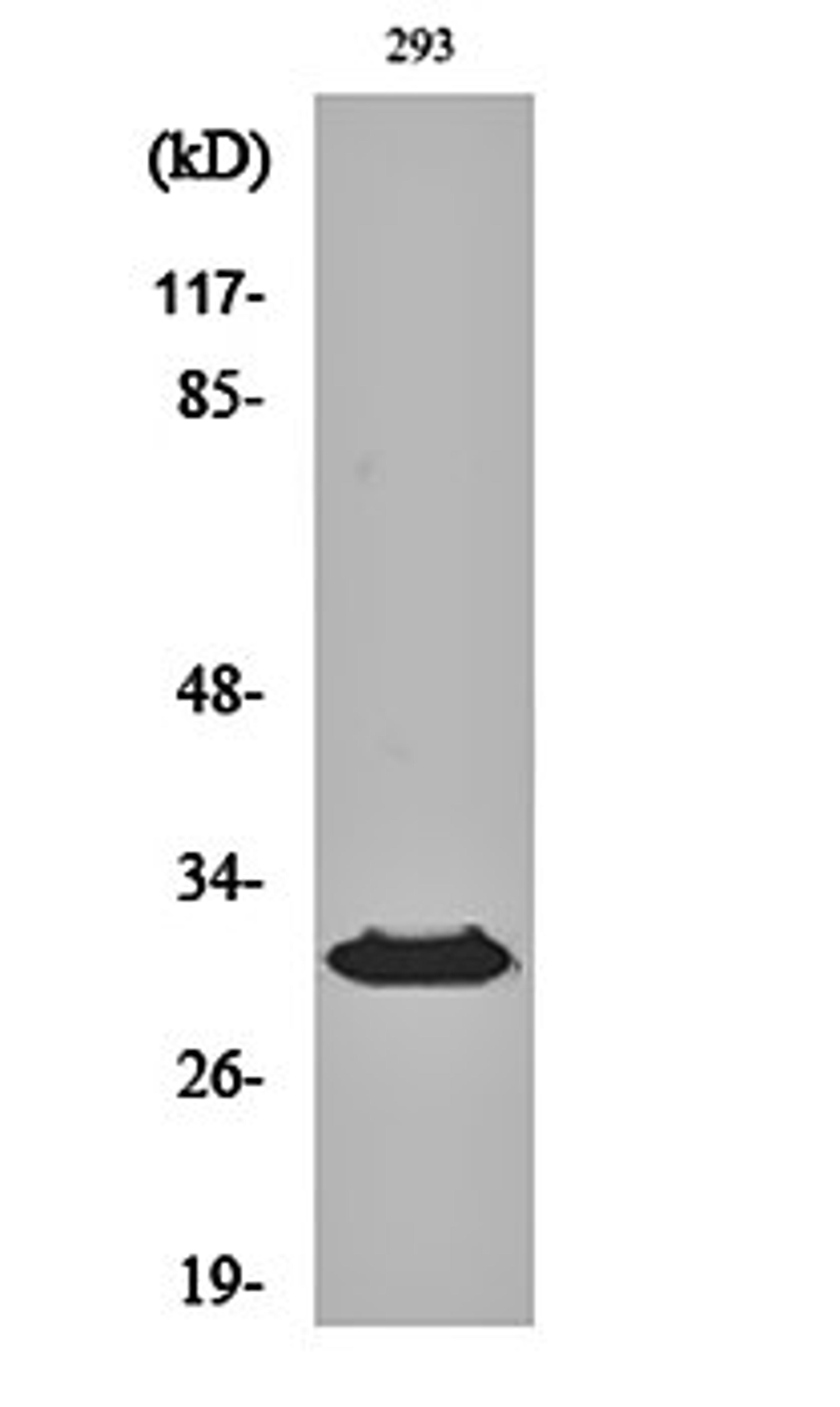 Western blot analysis of 293 cell lysates using HLA-DO beta antibody