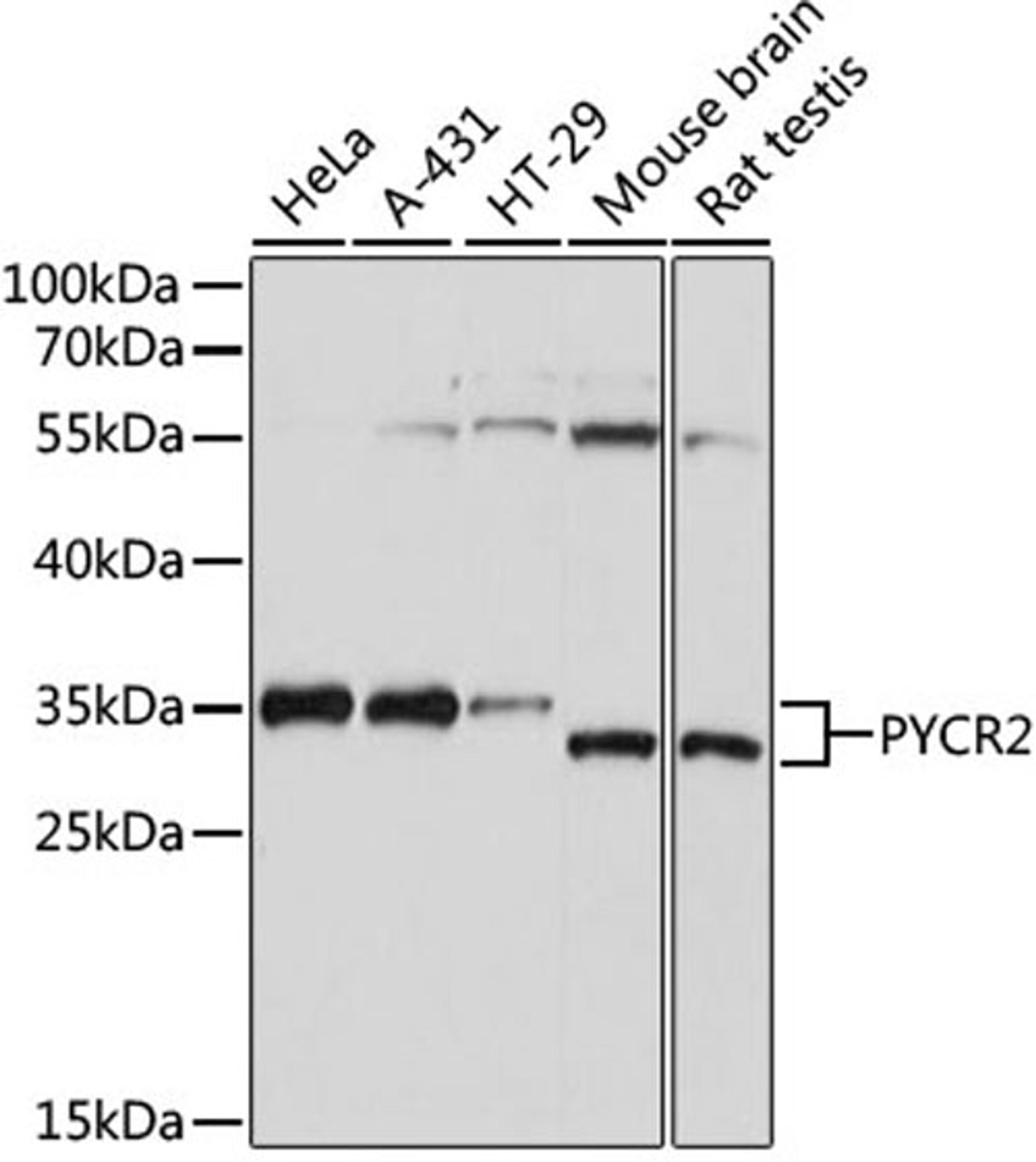 Western blot - PYCR2 antibody (A15155)