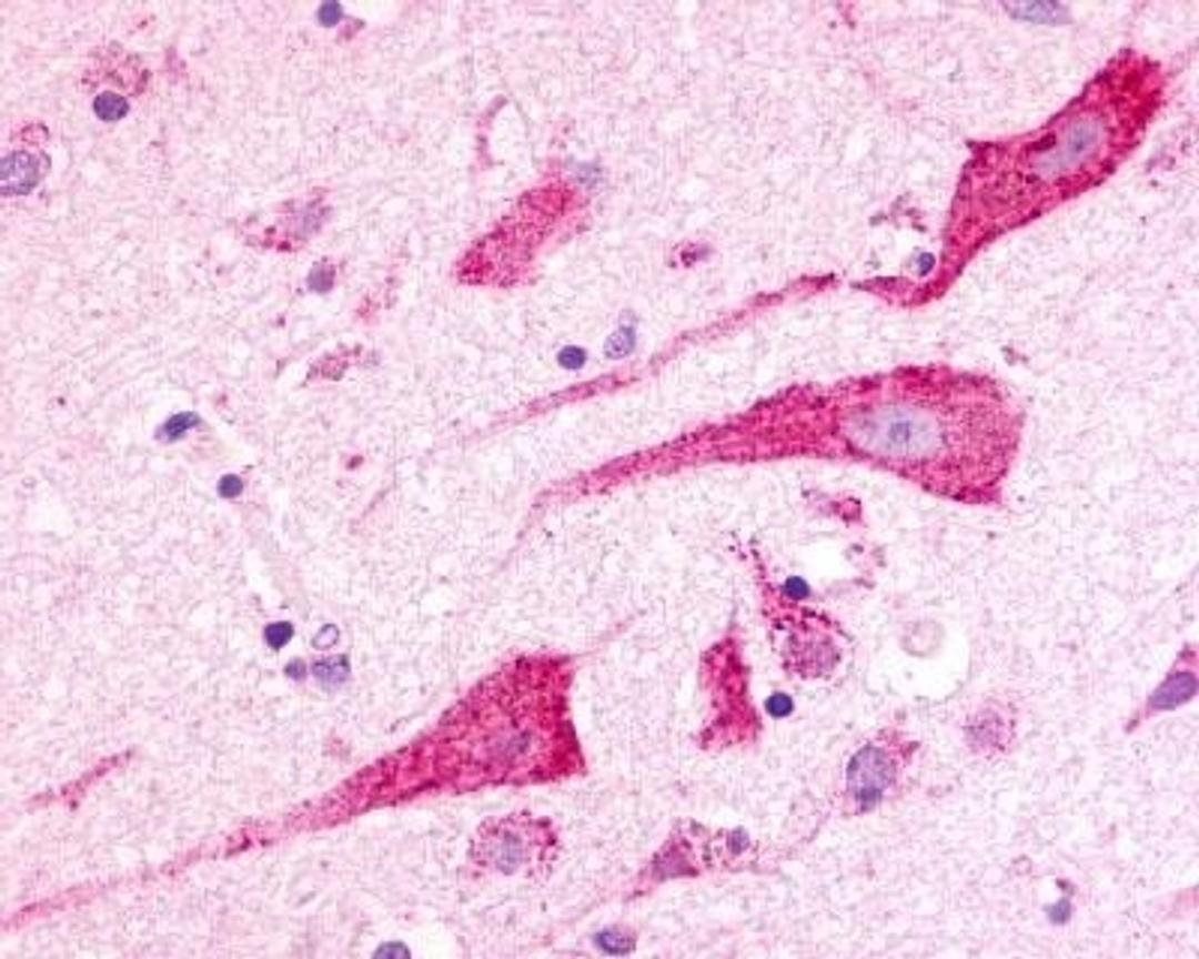 Immunohistochemistry: Latrophilin 3/LPHN3 Antibody [NLS1138] - Analysis of anti-LPHN3 / Latrophilin-3 antibody with brain, neurons, and glia.