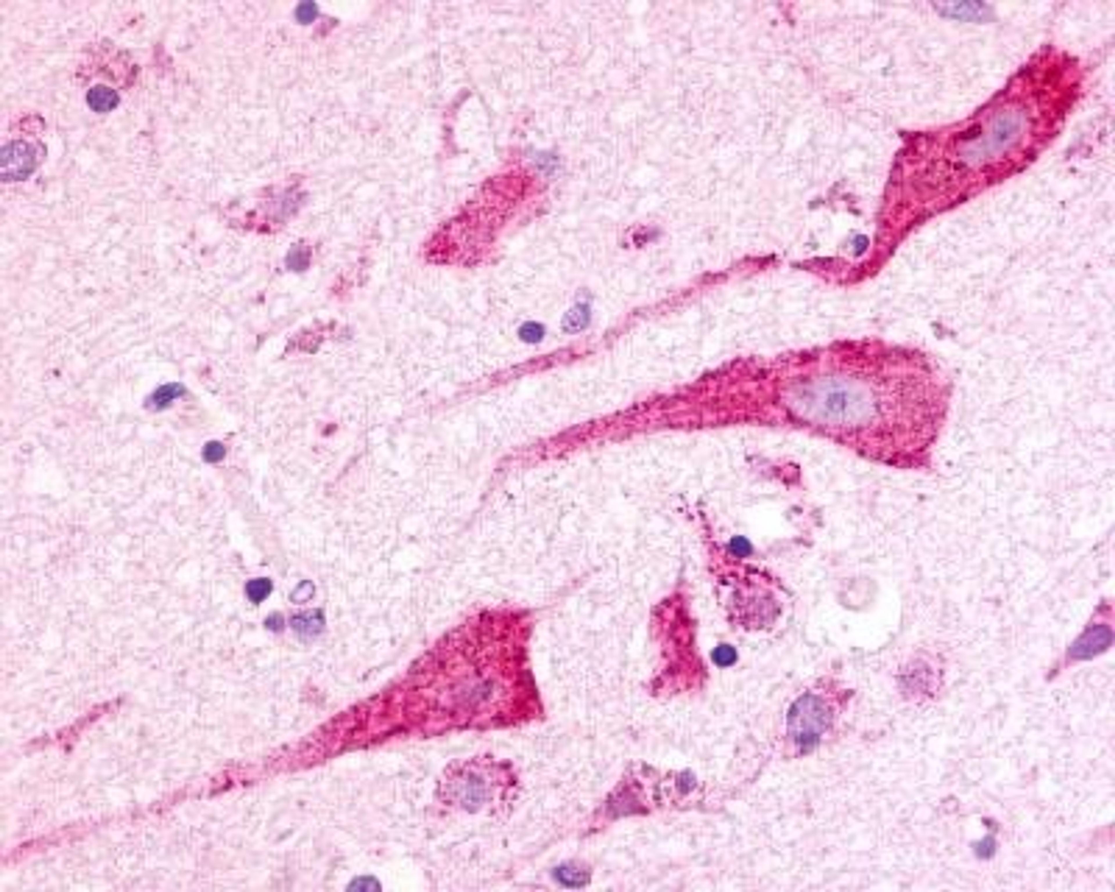 Immunohistochemistry: Latrophilin 3/LPHN3 Antibody [NLS1138] - Analysis of anti-LPHN3 / Latrophilin-3 antibody with brain, neurons, and glia.