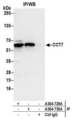 Detection of human CCT7 by western blot of immunoprecipitates.