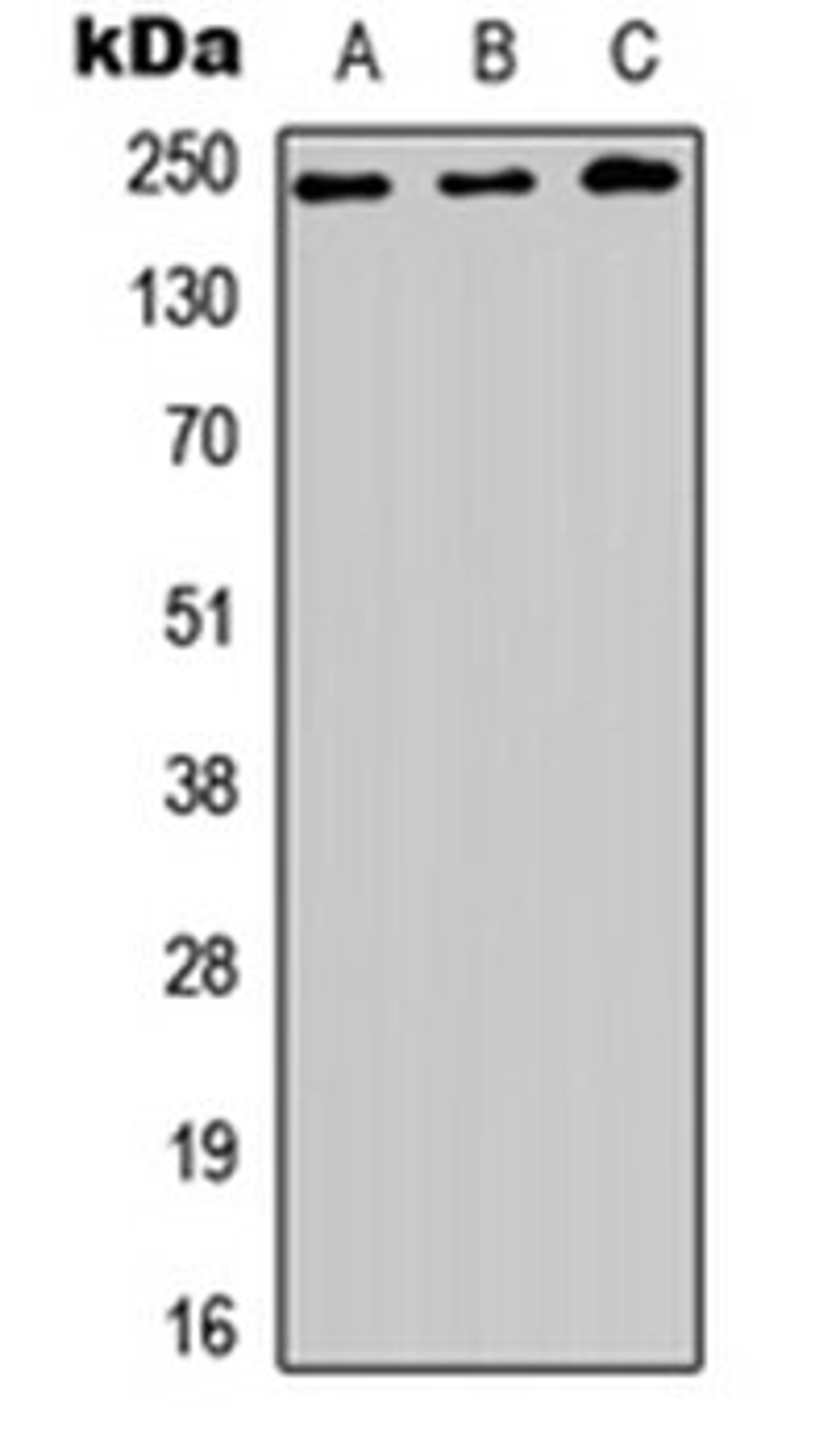 Western blot analysis of HEK293T (Lane 1), NS-1 (Lane 2), PC12 (Lane 3) whole cell lysates using BAP28 antibody