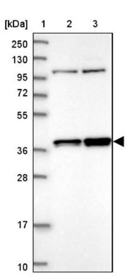 Western Blot: FAM131A Antibody [NBP1-91167] - Lane 1: Marker [kDa] 250, 130, 95, 72, 55, 36, 28, 17, 10<br/>Lane 2: Human cell line RT-4<br/>Lane 3: Human cell line U-251MG sp